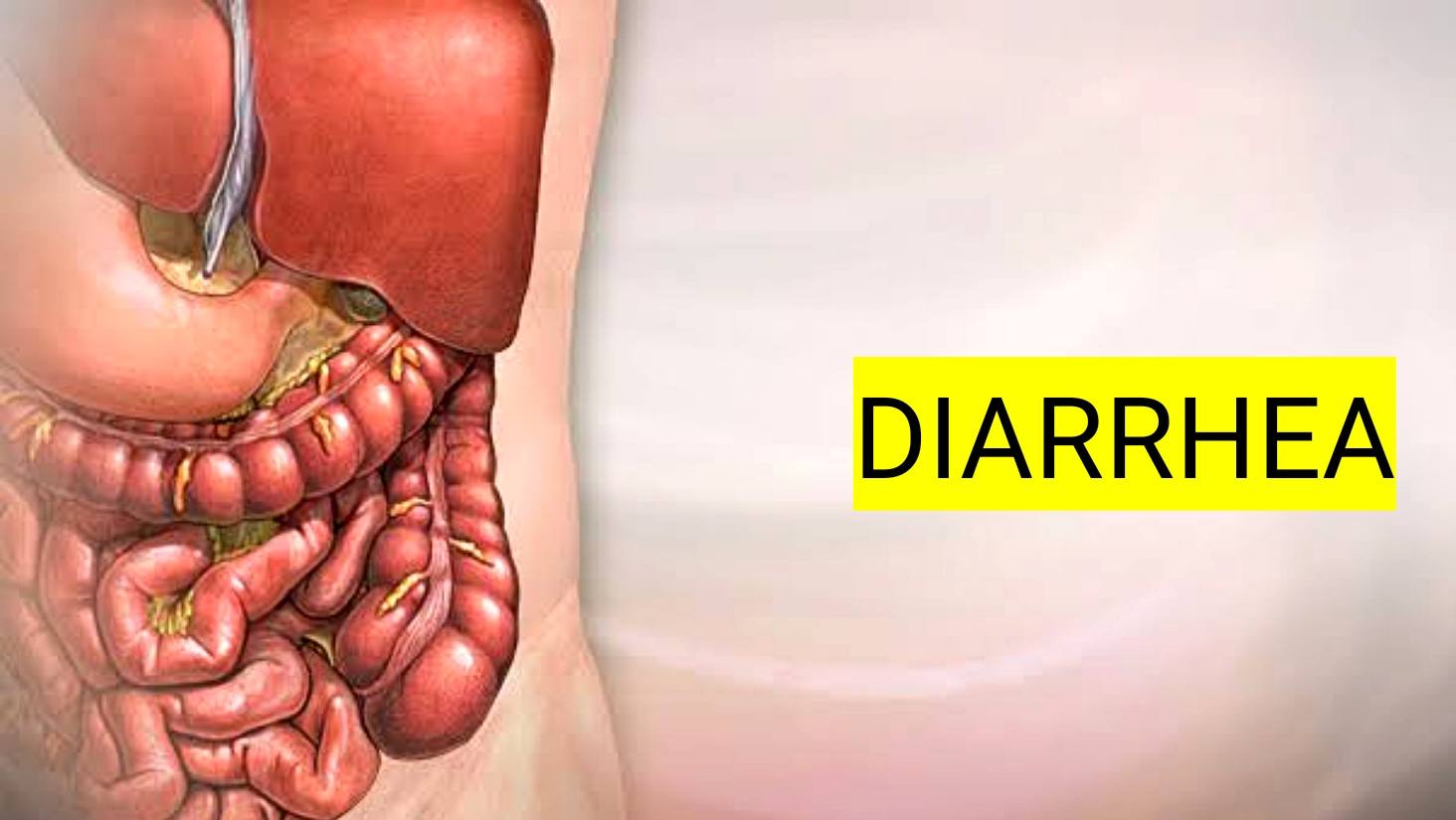 A Structure of Diarrhea
